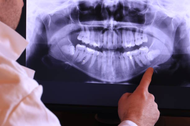 Best Pediatric Emergency Dentist in Folly Beach, SC